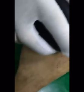 BB7 - Epilator Alat Penghilang Bulu Ketiak Kaki Epilator Hair Remover Pembersih Daki Kulit Mati