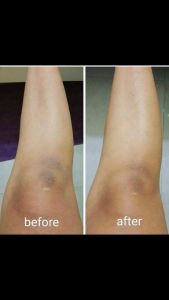 Lebih Hemat! 2 PCS Underarm Cream Pemutih Selangkangan Alami with Baltikh Extract Bakuchiol dan Niacinamide AMPUH dan ORI