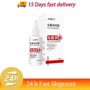 Hair Scalp Treatment Spray Remove Dandruff Itching Oil Control Anti Loss Scalp Cleaning Repair Serum Beauty Hair Care Products
