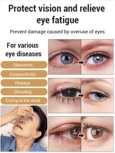 ✨Buy 1 get 2 free✨Lutein Blue Light Protection Eye Liquid / Anti-Dry Eye Liquid / Antioxidant Eye Liquid / Retina Health Eye Liquid / Lutein Eye Liquid Eye Nutrition Enhancer / Anti-Fatigue Eye Liquid / Vision Improvement Eye Liquid