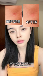 FACETOLOGY Triple Care Acne Calm Moisturizer 35gr