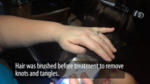 Sisir Serit Kerep Vakum Anti Sedot untuk Penghilang Telur Kutu Rambut