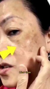 FUYAN Nicotinamide Spot Whitening Cream - Fu Yan Whitening and Freckle Removing - Andorheal Krim Penghilang Flek Hitam / Dark Spots
