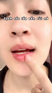 Tẩy Tế Bào Chết Môi Chính Hãng Heyxi Dưỡng Môi Và Chống Lão Hóa Cho Môi Hồng Căng Mọng