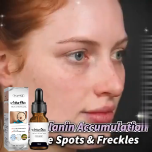 BOOM EELHOE Wart Removal Serum: Krim Penghilang Lalat & Kutil Mudah Dibawa