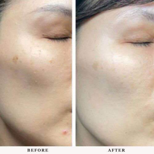 Dr.%20Ora%20AURA%20WHITE%20ULTRA%20Skin%20Whitening%20Supplement%20/%20Anti-aging%20/%20Brightens%20skin%20/Lightens%20Dark%20Spots%20/%20Whitening%20UV%20Protection%20Beauty%20Supplement%205g%20x%2030s%20%5BMulti%20Award%20Winning%5D%20-%20Image%209