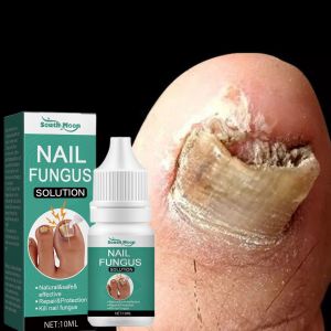 Nail Repair Essence Serum Original Serum Kuku | Perawatan Kuku Berjamur | Serum Penghilang Jamur Di Kuku | Vitamin Kuku Rusak | Memperbaiki Kuku Rusak