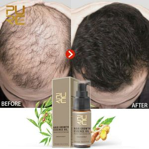 PURC prevent hair loss hair shampo growth 300ml essence oil 20ml dan spray 30ml penumbuh rambut