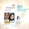 deep treatment essense DTE msglow original. 