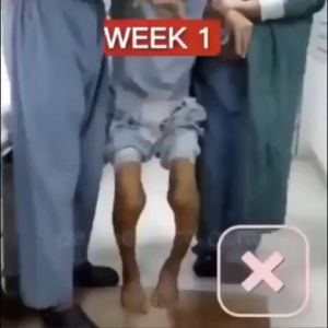 Bee Venom Treatment Gel joint and bone cream bee venom supplement treat joint knee pain toe bone pain relief of joint pain lumbar spine cervical spine musculoskeletal pain professional treatment kneeshoulder neckwaist and leg gel