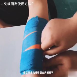 Splint Roll Patah Tulang Splinting Brace Support Pelindung Untuk Tangan Kaki Badan Patah Tulang
