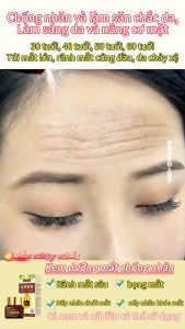 Kem dưỡng mắt kem mắt OSUFI kem làm sáng da mờ quầng thâm bọng mắt ngăn lão hoá ngừa nếp nhăn 20g-Beautify 4U