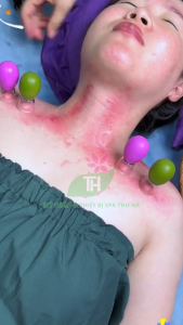 Cốc Giác Hơi Cạo Gió Mặt Body Nâng Cơ Mặt Thông Kinh Lạc