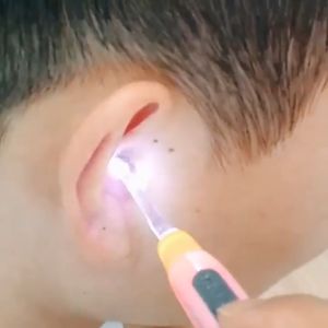 Dụng Cụ Lấy Ráy Tai Có Đèn Đầu Mềm An Toàn Cho Bé - Lấy ráy tai có đèn 3 đầu