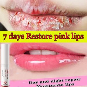 Lip Mask Lip Balm 7.5ml Removal of dark dead and dry skin on lips Lip care Lip foam Lip balm Moisturizer for dark lips Effective removal of black on lips Lightening of dark lip melanin Moisturizer Wipe on lip care