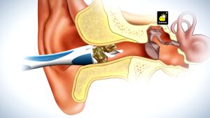 [MH] Pembersih Telinga Korek Kuping Smart Swab