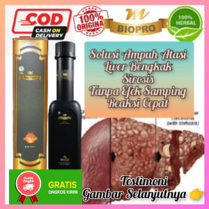 Obat Liver Paling Ampuh Obat Liver Alami Paling Ampuh Isi 380 ml M Biopro Herbal Alami Terbukti Ampuh