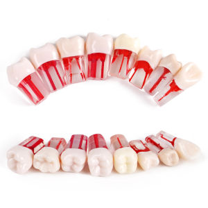 5pcs ทันตกรรมฟัน Root Canal รุ่น Pulp ไฟล์ Cavity Endodontic Practice BLOCK Endo แฟ้มเรซิ่นฟันทันตกรรมการสอนวัสดุ