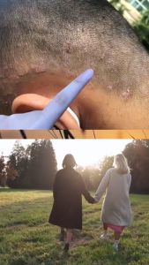 Dầu thiên nhiên Toonic Aroma cải thiện xóa gàu nấm da đầu nấm móng vảy nến chàm 30ml