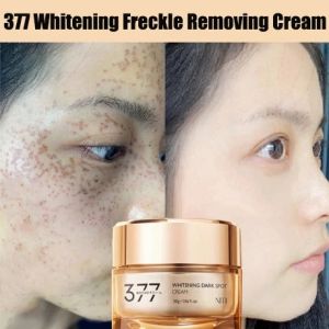 melasma and pekas remover cream original melasma remover from japan melasma cream pekas remover dark spots remover whitening Freckle Cream melasma cream to remove dark spots pekas cream melasma remover watson