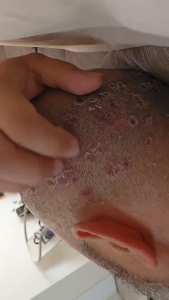 Minyak Geronggang Solusi Gatal Selangkangan dan Kulit Sensitif Kualitas Terjamin - 1 Botol