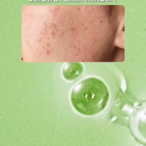 Promo Diskon! Glad2Glow Acne Jerawat Bundle 7in1 paket Centella madeca cream-Moisturizer+Serum+Cleanser+Toner+Clay