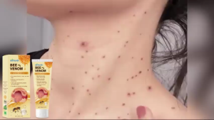 Ximonth Herbal Cream: Relieves Eczema and Skin Itching Gently Cleanses Moisturizing Care Anti-Itch Body Cream