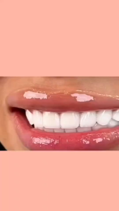 [ DuoDuo]Optical color trimming Tooth Whitening Essence 30ml