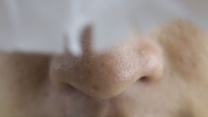 Mặt Nạ Đẩy Mụn Đầu Đen Ciracle Goodbye Blackhead 5ml