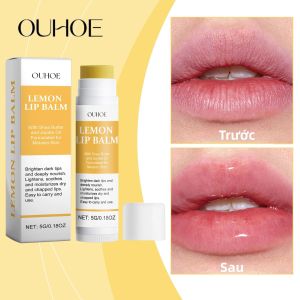 Son Dưỡng Môi Làm Sáng Môi Ouhoe Hàn Quốc Giảm Melanin Tẩy Tế Bào Chết Dưỡng Ẩm Làm Bóng Môi Dầu Dưỡng Môi Cho Môi Mềm Mại 5g