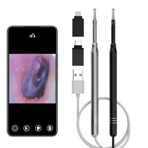 ทําความสะอาดหูกล้อง Endoscope TYPE-C Micro USB 5.5 มม.3.9 มม.3in1 Visual EAR Picker ช้อนหู 6LEDs Otoscope สําหรับโทรศัพท์ Android PC