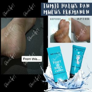 Krim Penghalus Tumit Kaki Pecah dan Kering: Bio Herbal Foot & Heel Cream