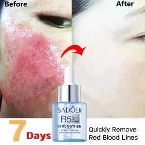 SADOER | Facial Redness Repair Serum Improve Sensitive Muscles Acne Rosacea Dry&Itchy Skin Moisturizer Lotion Korean Skin Care Products