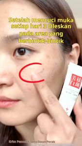 FUYAN Krim Melasma Menghilangkan Bintik Flek Hitam dan Memutihkan Wajah Whitening Freckle Removing Dark Spots