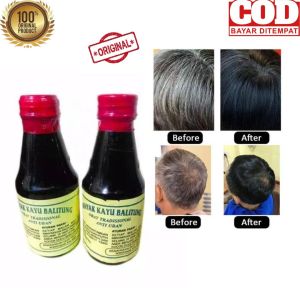 Minyak Kayu Balitung Anti Uban Atasi Kebotakan Perawatan Rambut Uban Perawatan Rambut Rontok
