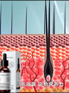 Hair Growth Serum 60ml Hair serum Hair tonic Hair Thickening Anti Hair Promote Hair Growth Herbal Anti Hair Loss 生发液