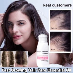 Hair Conditioning Spray Dense Hair Strengthening AntiHair Fall Hair Strengthening Hair Spray