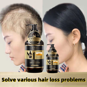Black Hair Shampoo rambut gugur Anti off shampoo 400ml Penumbuh rambut growth pelebat rambut prevents hair loss mild and non-irritating Ginger Hair Regrowth Dense Fast Anti Hair Loss Repair Damaged Hair Preventing Hair Fall Nourish