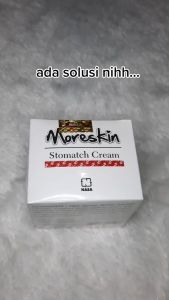 Moreskin Stomatch Cream NASA - Krim Susut Lemak Perut Buncit & Paha dan Lengan Glambir