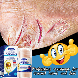 Vaseline body lotion Moisturising Cream Stick Anti-Dry Hand & Foot Cream Heel Moisturising Repair Anti-Drying Crack Foot Cream Hand Cracked Repair Feet Hand Care Skin Dead Skin Removal