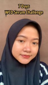 Serum White Cell DNA