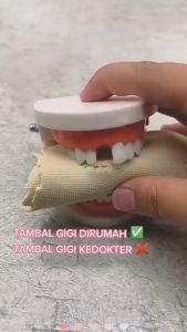 ASLI Obat Tambal Gigi Bolong Penambal Penutup Gigi Ompong Depan Gigi Palsu Temptooth Original Temporary Gigi Palsu Penutup Gigi Berlubang Palsu LEpas Pasang Atas Kelinci Depan Gingsul Instan Tempel Permanen Super Kuat Penambal Gigi Ompong
