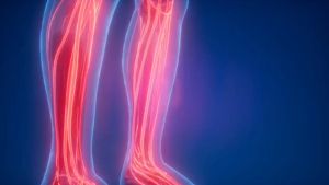 Obat Darah Tinggi Ampuh - Hipertensi - Kolestrol Tinggi - Kontrol Darah  | Apirex Bharata Garansi 100% Original