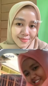 LUMIWHITE  Paket Brightening + Serum Luxury Gold