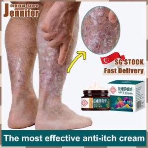 💥SG Stock💥 Herbal eczema cream / Anti itch cream / Itchy skin cream / Psoriasis cream / Antifungal cream / 皮膚止痒 / 濕疹药膏 / 止癢膏