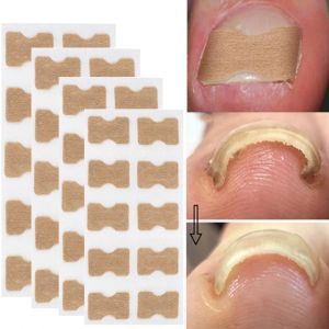 การแก้ไขเล็บกันน้ำ 50 ชิ้นแผ่น แผ่นปะติดตัวแก้ไขกู้คืนเครื่องมือ 50 ชิ้น