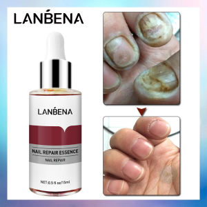 LANBENA Nail Repair Essence Serum Fungal Nail Treatment Remove Onychomycosis Toe Hand Foot Skin Care