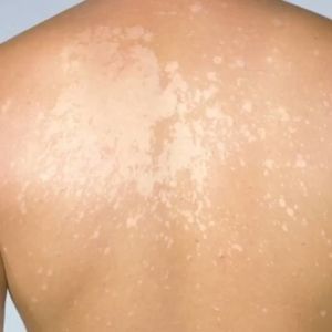 Sabun Waji - Sabun Gatal Gatal Bebaskan Bakteri Pada Tubuh Panu Kadas Kurap & Eksim Alergi Kulit