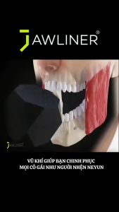 Dụng Cụ Tập Cơ Hàm Nâng Cơ Mặt Thon Gọn Khuôn Mặt Vline Giảm Mỡ Có Hộp Đựng Tiện Lợi Tăng Cường Cơ Hàm Chắc Khỏe