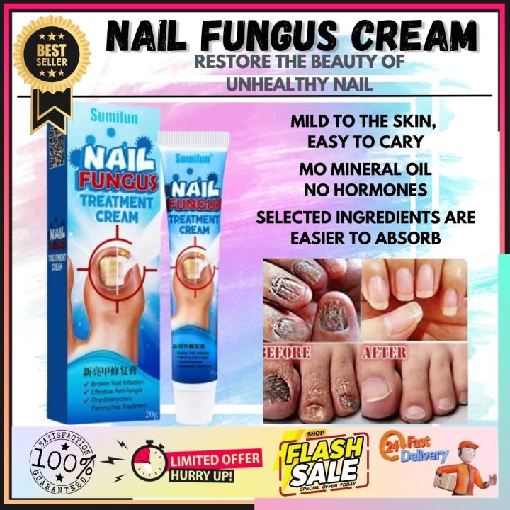 💯✅ SUMIFUN NAIL FUNGUS TREATMENT CREAM Fungal Nail Removal Onychomycosis Paronychia Anti Fungus Infection Toe Nail Nourishing Brightening Hand Foot Nail Antibacterial Care 💯✅